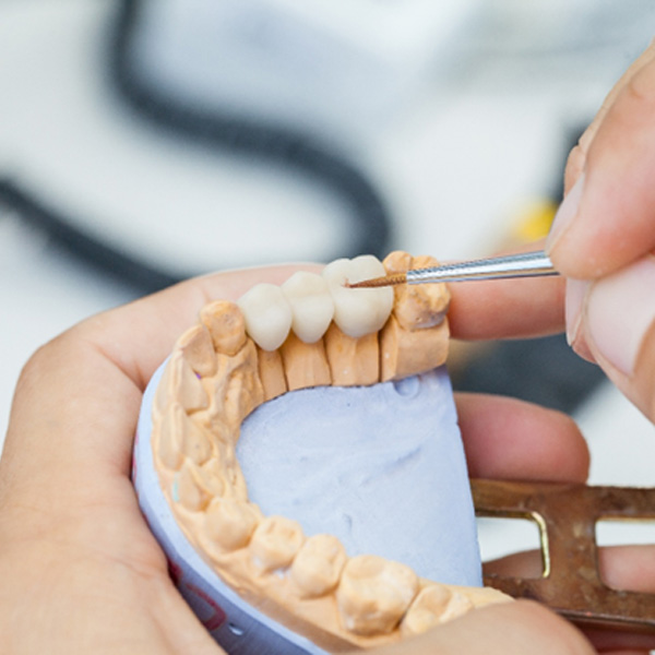 A dental technician working on a dental bridge