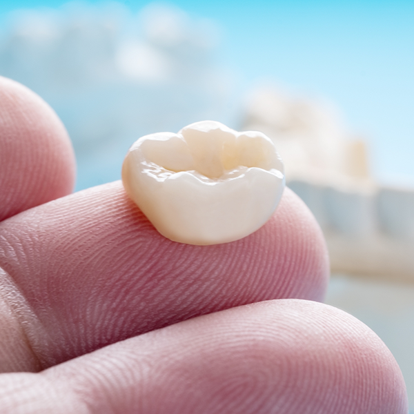 Close up of a porcelain dental crown resting on a person's finger