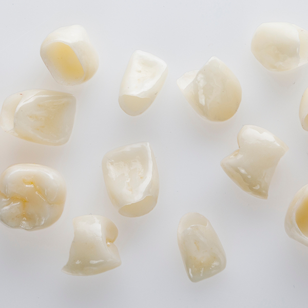 Several tooth colored dental crowns