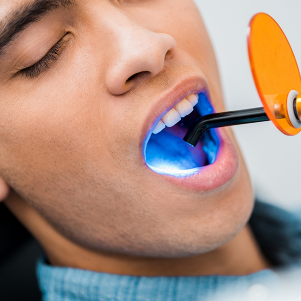 Dental patient having an ultraviolet light applied to their tooth