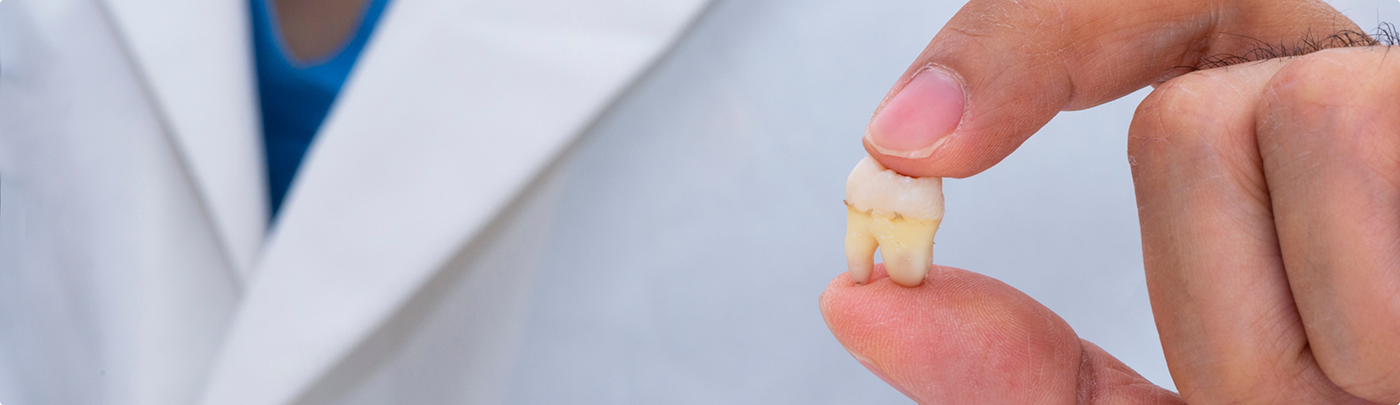 Dentist holding an extracted tooth