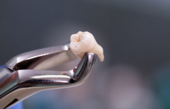 What Is The Tooth Extraction Healing Timeline? Frisco, TX